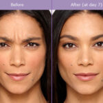 Torrance Plastic Surgery Treatments