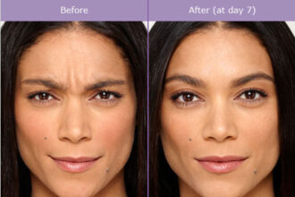 Torrance Plastic Surgery Treatments