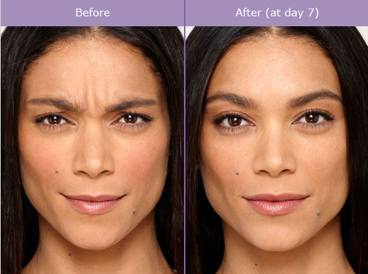 Torrance Plastic Surgery Treatments