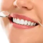 Smile Imperfections